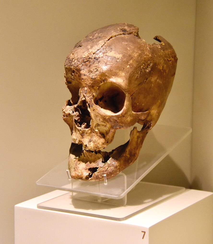 Skull of King Midas of Phrygia